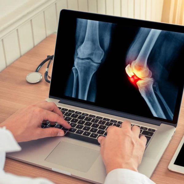 Punto-Clinico-Especialistas-Ortopedista